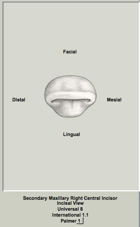 Ext Morph Mx Central Incisal 1.png